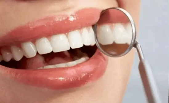 Advantages of Using Dental Composite Materials in Modern Dentistry