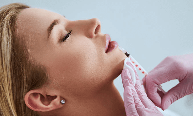 Dermal Filler