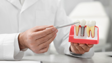 How Dental Implants Can Completely Transform Your Smile (And Your Confidence)