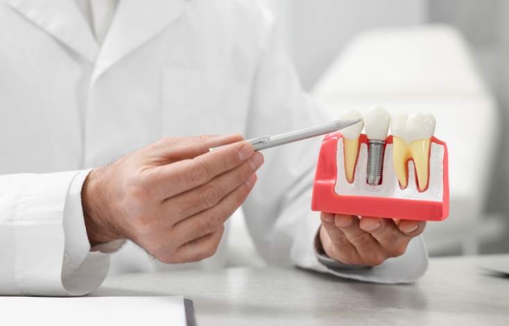 How Dental Implants Can Completely Transform Your Smile (And Your Confidence)