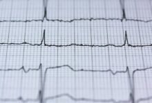 contact pulse start unlocking caller