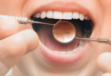 Smart Ways To Keep Your Smile Healthy Between Dental Appointments